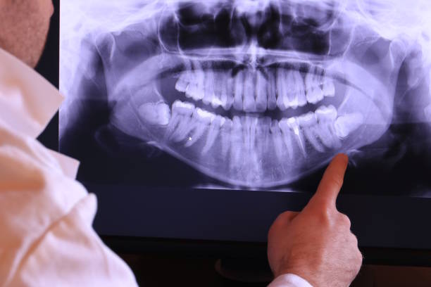 Best Emergency Broken Tooth Repair in Ocean Park, WA
