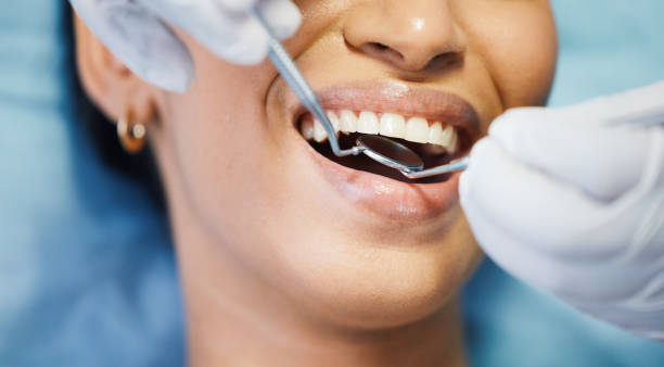 Best Walk-In Emergency Dentist in Ocean Park, WA