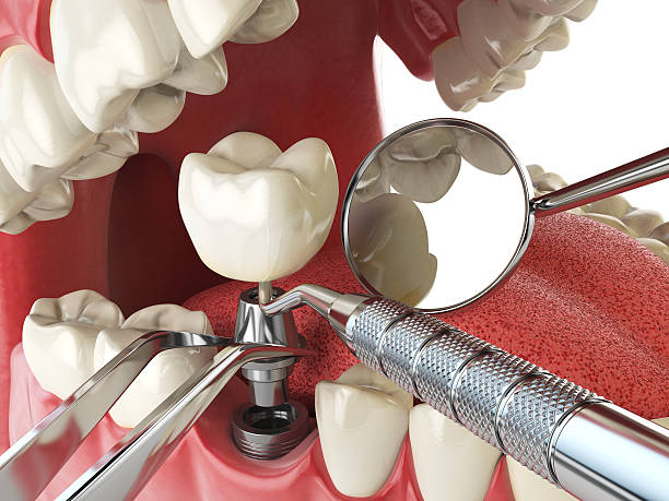 Best Emergency Dental Care for Trauma or Injury in Ocean Park, WA